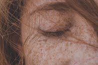 Detailed close-up of a freckled face with closed eye and hair, highlighting skin texture.